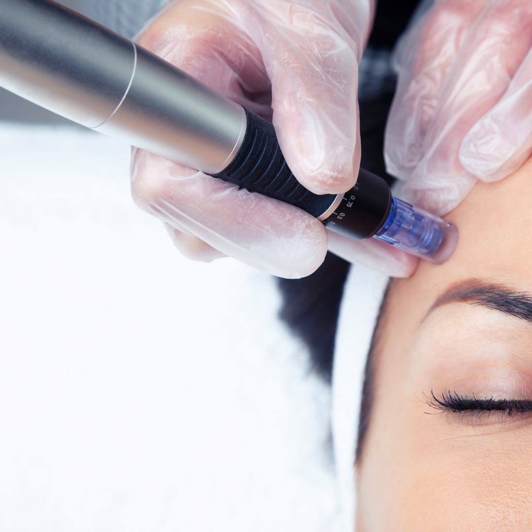 NynyInk - Tattoo Piercing - Microneedling