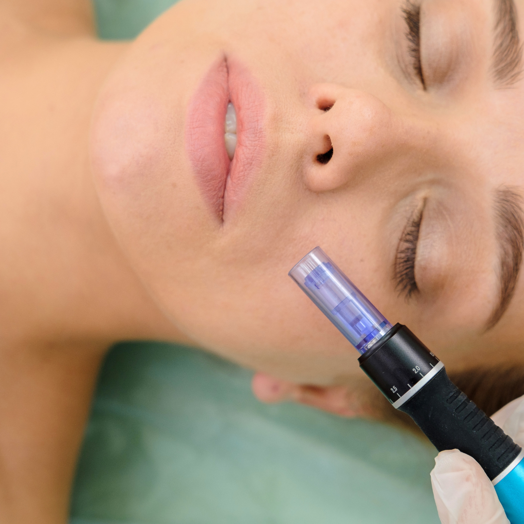 NynyInk - Tattoo Piercing - Microneedling
