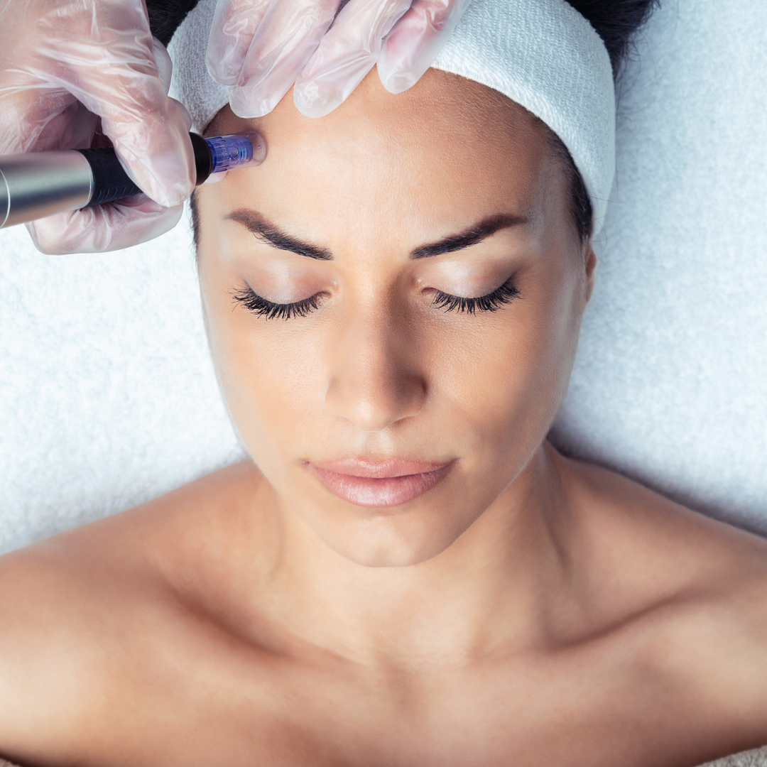 NynyInk - Tattoo Piercing - Microneedling