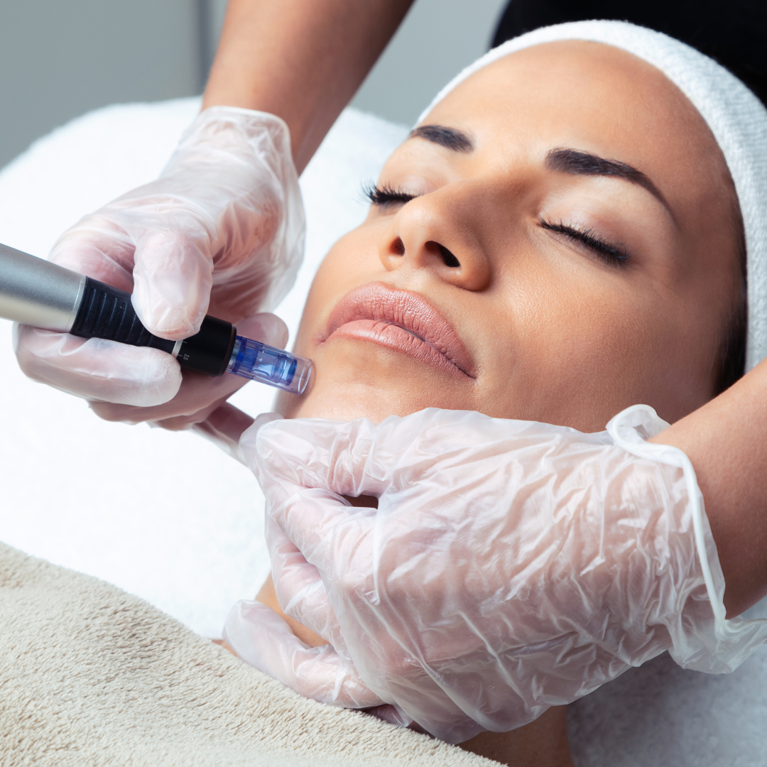 NynyInk - Tattoo Piercing - Microneedling