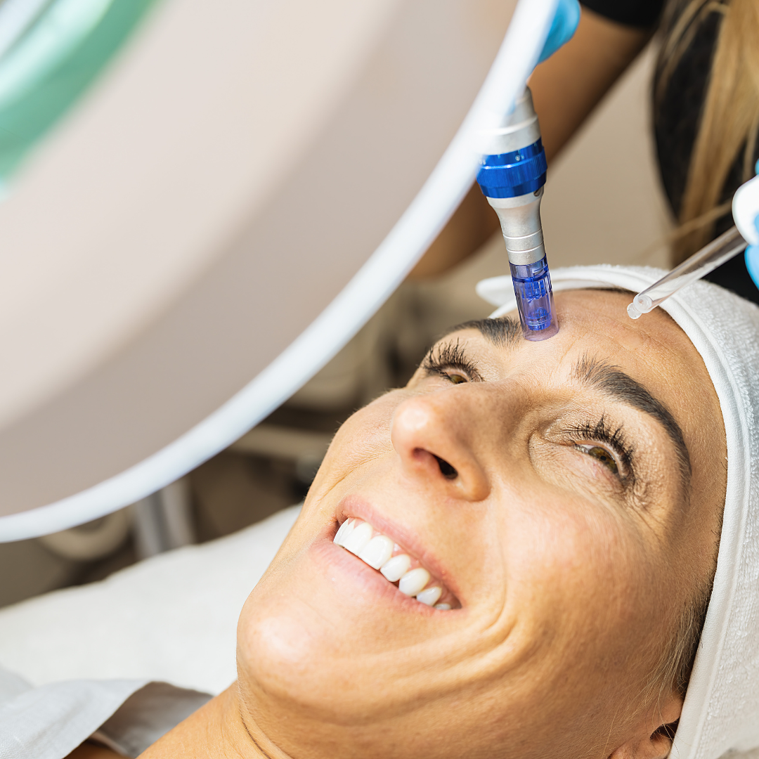 NynyInk - Tattoo Piercing - Microneedling